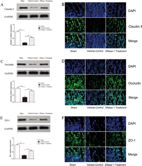 DNase-1 Treatment Exerts Protective Effects in a Rat Model of Intestinal Ischemia-Reperfusion ...