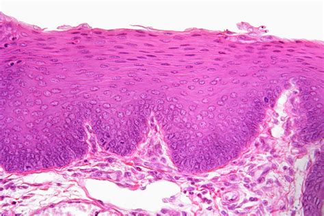 Stratified Squamous Epithelium From Human Hand Skin Showing Keratinized | My XXX Hot Girl