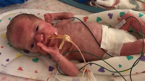 Mom who gave birth to 1 pound baby gets to hold her for first time