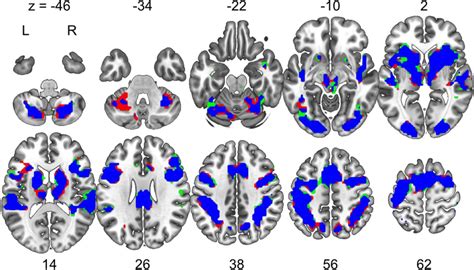 Activation of brain regions observed in fMRI scans during the tasks ...