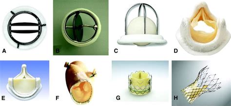 Different types of artificial heart valves. (A) bileaflet mechanical ...