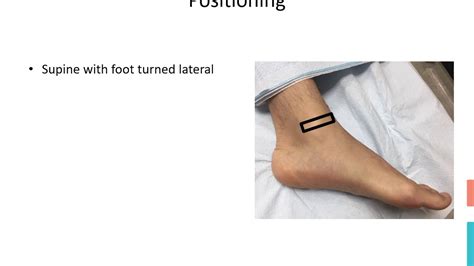 Ankle Nerve Block Procedure