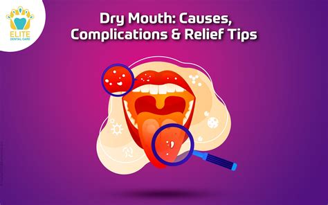 DRY MOUTH: CAUSES, COMPLICATIONS & RELIEF TIPS | Elite Dental Care