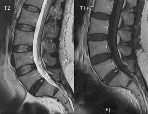 Pin on PORPHYRIA