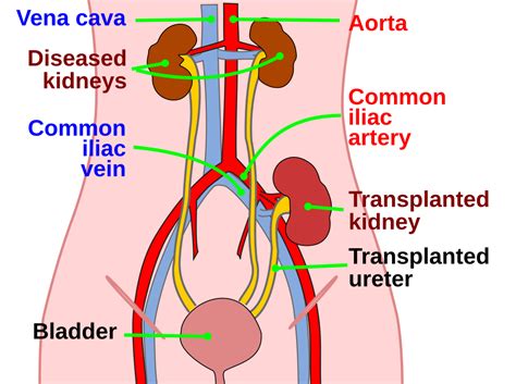 Renal Transplantation | Kidney Transplant | Geeky Medics