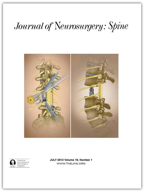 Anatomical study of superior cluneal nerve entrapment in: Journal of ...