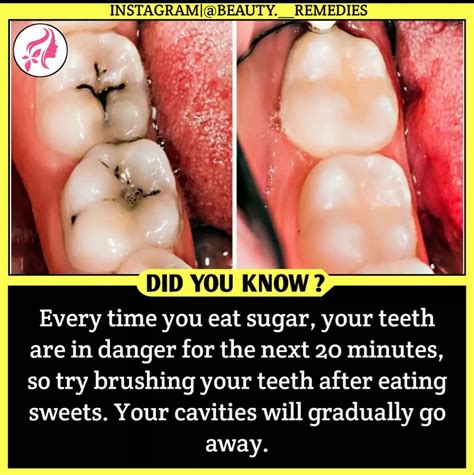 Prevent cavities 🦷