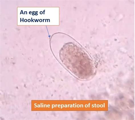 Hookworm Egg in saline preparation: Introduction, Life cycle, Pathogenecit