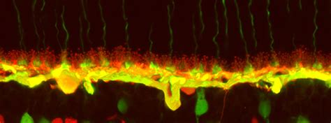 Horizontal cells – Retinal Microscopy