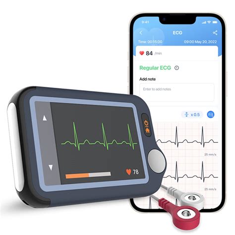 Home EKG Monitor,Personal ECG Monitor for 30s/60s/5min Recording ...