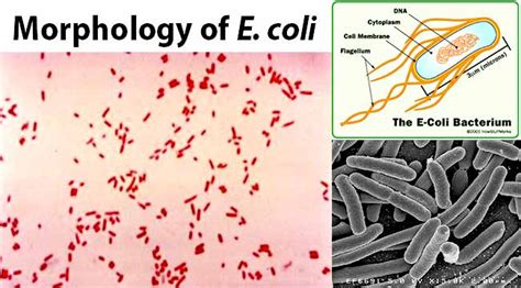 E. coli (Escherichia coli)- An Overview - Microbe Notes