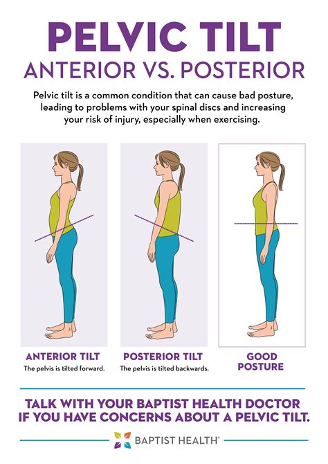 Posterior Pelvic Tilt