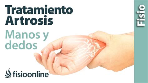 Tratamiento de fisioterapia para la artrosis de manos y dedos - YouTube