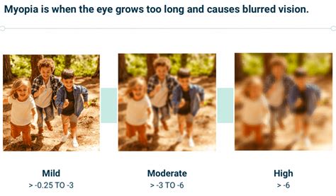 Pediatric Myopia – Vyluma | Ophthalmic Pharmaceutical Solutions