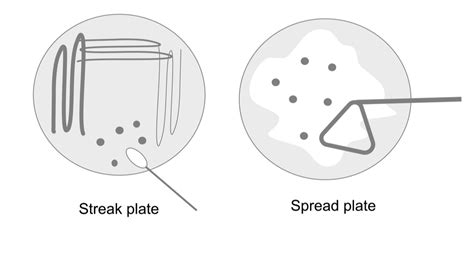 Isolation of Pure Culture by Streak Plate Method and Other Techniques