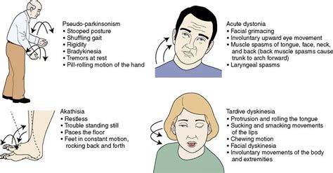 Image result for tardive dyskinesia | Nursing school notes, Nursing fun, Nursing school studying