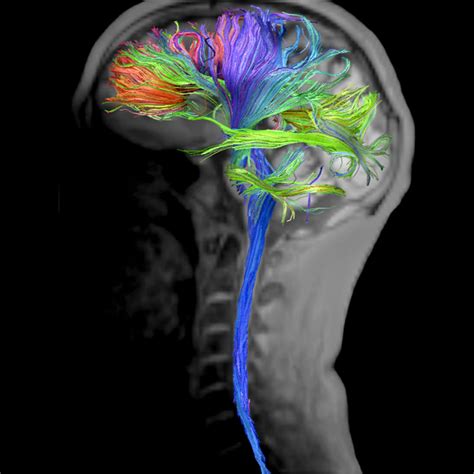 Virgin MRI VS Chad Pet Scan : r/virginvschad