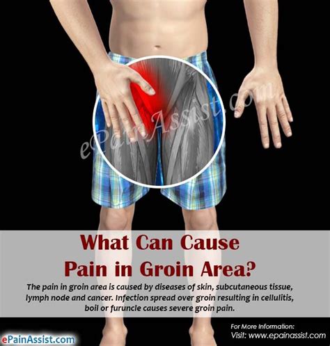 Men's Groin Area Diagram