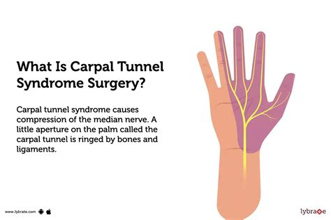 Carpal Tunnel Syndrome Surgery: Purpose, Procedure, Benefits and Side ...