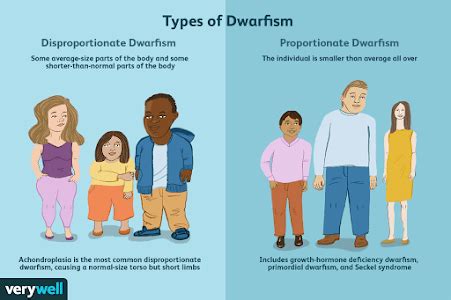 Dwarfism - Symptoms and Impacts