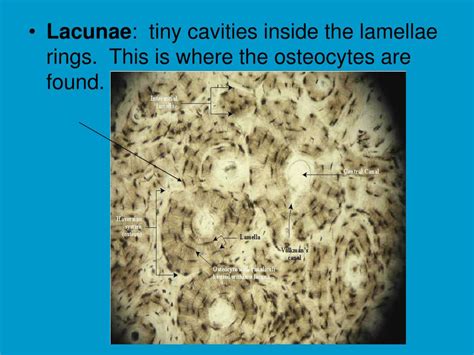 PPT - Bone Histology PowerPoint Presentation, free download - ID:6535425