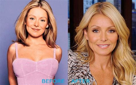 Kelly Ripa before and after plastic surgery (20) – Celebrity plastic ...