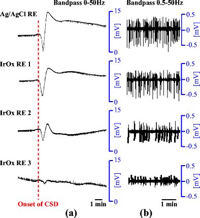 The depth ECoG signals: a DC-ECoG and b AC-ECoG at different distances... | Download Scientific ...