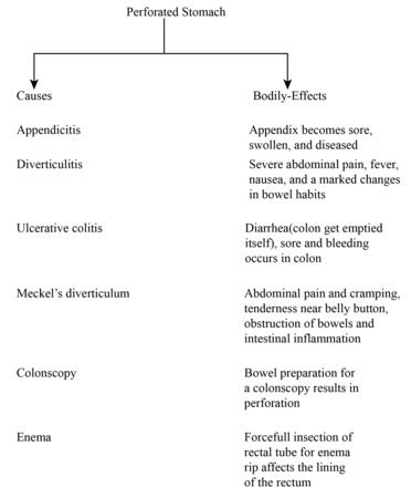 Perforated Bowel | Definition, Symptoms & Causes - Lesson | Study.com