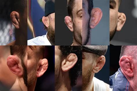 The 10 Worst Cauliflower Ear UFC Fighters in 2021 – Fightnomads Combat Sports Life Blog