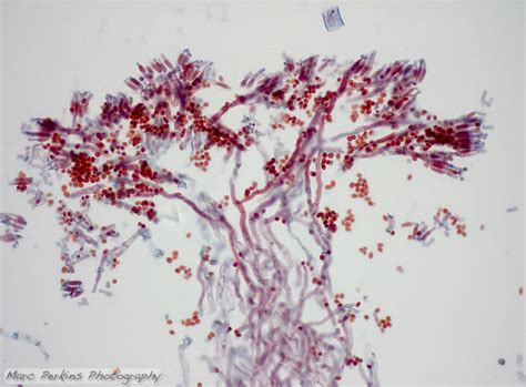 Penicillium Notatum Under Microscope