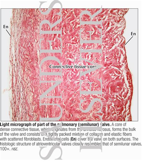 Light Micrograph of Part of the Pulmonary (semilunar) Valve