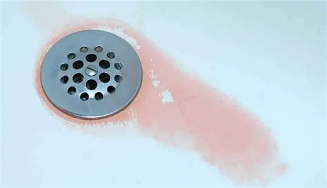 Shower Mold Removal : How to Clean Mold in Shower