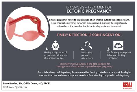 Diagnosis and treatment of ectopic pregnancy | British Columbia Medical Journal