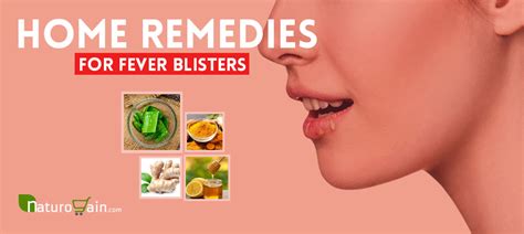 12 Easy and Best Home Remedies for Fever Blisters that Work [Naturally]