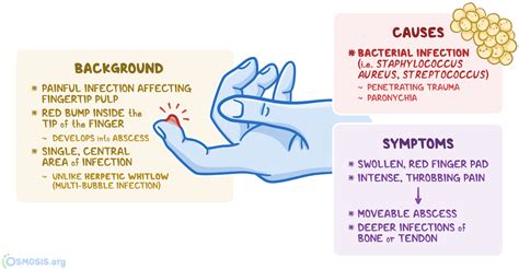 Felon Finger: What Is It, Causes, Appearance, Diagnosis, Treatment, and ...