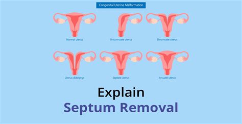 Uterine Septum: Symptoms & Treatment | Birla Fertility & IVF