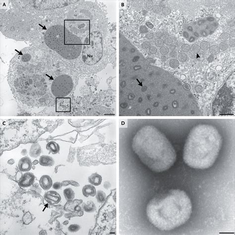 The Novel Orthopoxvirus on Transmission Electron Microscopy ...