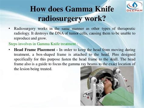 Gamma Knife Radiosurgery - Precise, Powerful & Proven