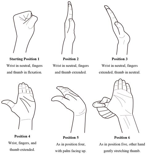 JCM | Free Full-Text | Sensory Nerve Conduction Velocity Predicts Improvement of Hand Function ...