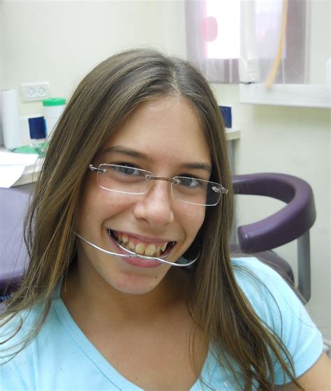 Pin by b on Headgear | Braces girls, Teeth braces, Dental braces