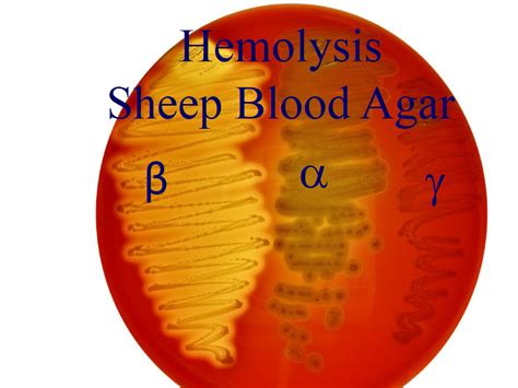 This sheep blood agar plate shows Beta, alpha and gamma hemolysis. Technology Lab, Medical ...