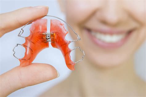 What Should I Do If I Break Or Lose My Retainer?