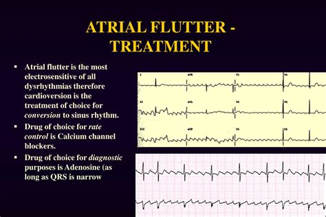 Icd 10 code for atrial flutter - minestream