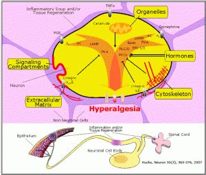 hyperalgesia – Dr Rajiv Desai