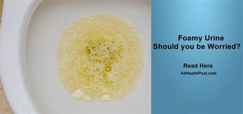 Foamy Urine 】- Should You be Worried? Is it Normal?