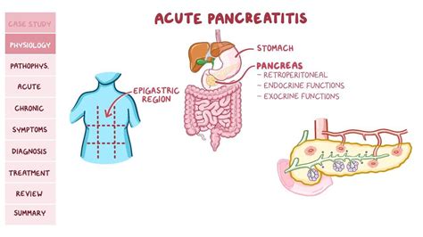 Cullen Sign: What Is It, Causes, Symptoms, and More | Osmosis