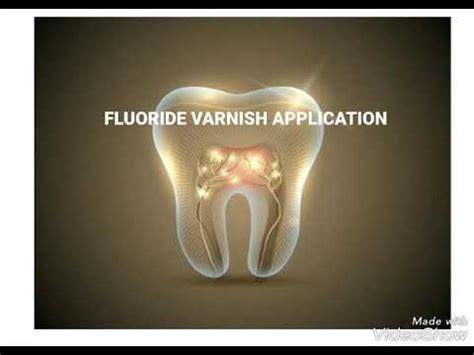 Dental fluoride varnish application ppt - YouTube
