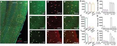 Frontiers | A Characterization of the Electrophysiological and Morphological Properties of ...