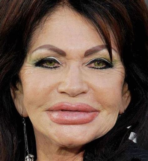 Plastic Surgery Disasters - AllDayChic