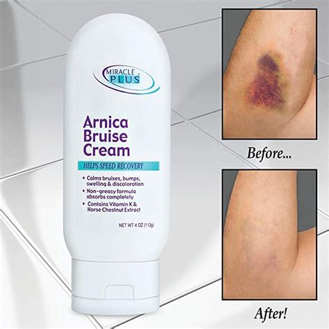 “The Best Bruise Creams for Facial Bruises” - Twobabox.com